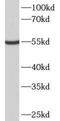 METTL4 Antibody - BSA Free