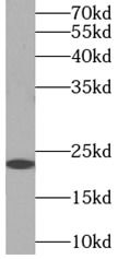 Myosin light chain 3 Antibody - BSA Free