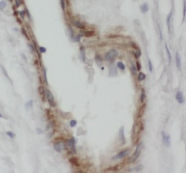 CGRP2 Antibody - BSA Free