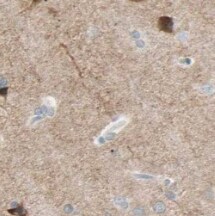 SLC30A3 Antibody - BSA Free