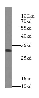 ZNRF2 Antibody - BSA Free