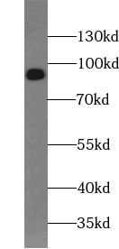 MCC2 Antibody - BSA Free