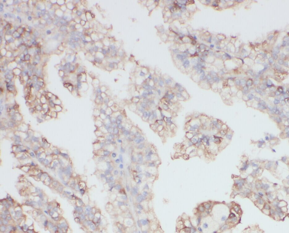 NY-REN-50 antigen Antibody - BSA Free