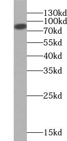 NY-REN-50 antigen Antibody - BSA Free