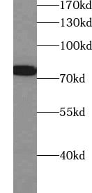 ZNF750 Antibody - BSA Free