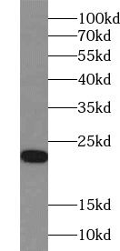 ZNF747 Antibody - BSA Free