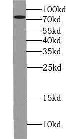 ZNF699 Antibody - BSA Free