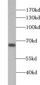Zinc finger protein 668 Antibody - BSA Free