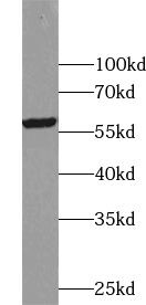 ZNF649 Antibody - BSA Free