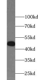 ZNF645 Antibody - BSA Free
