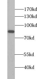 ZNF611 Antibody - BSA Free