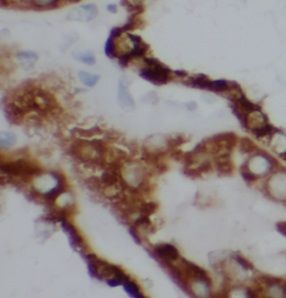 TULP4 Antibody - BSA Free