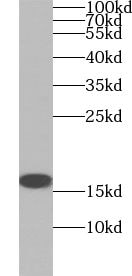 ZNF593 Antibody - BSA Free