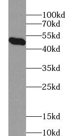 ZNF557 Antibody - BSA Free