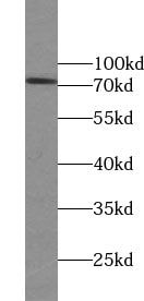 FLJ13946 Antibody - BSA Free