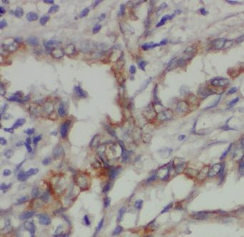 CPNE8 Antibody - BSA Free