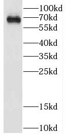 CPNE5 Antibody - BSA Free