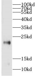 CPLX3 Antibody - BSA Free