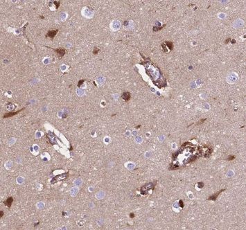 Complexin-1 Antibody - BSA Free
