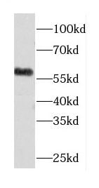 CORO6 Antibody - BSA Free