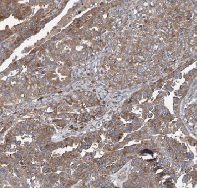 Coronin-2B Antibody - BSA Free
