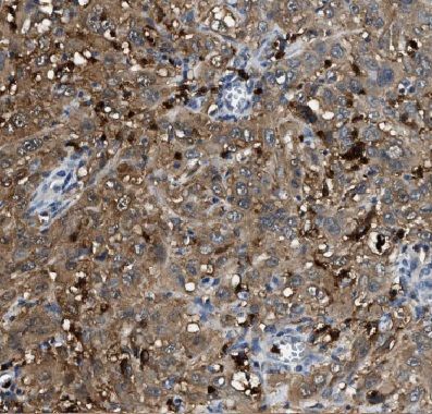 Coronin 3 Antibody - BSA Free