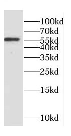 Coronin 3 Antibody - BSA Free