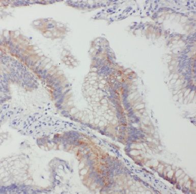 Connexin 26/GJB2 Antibody - BSA Free