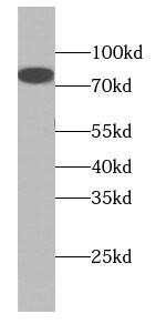 Collagen VIII alpha 1 Antibody - BSA Free