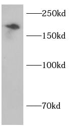 COL4A2 Antibody - BSA Free