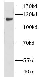 CNOT3 Antibody - BSA Free