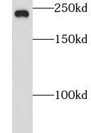 CNOT1 Antibody - BSA Free