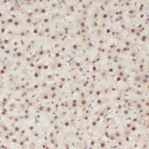 CLYBL Antibody - BSA Free