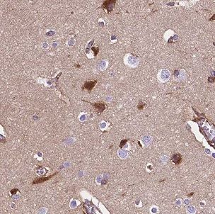 CLN3 Antibody - BSA Free