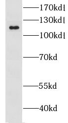 CYLN2 Antibody - BSA Free