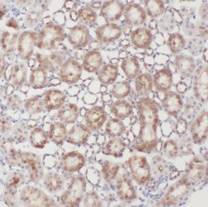 CLEC18A Antibody - BSA Free