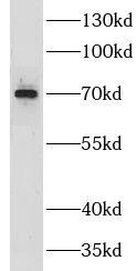 CLCNKA Antibody - BSA Free