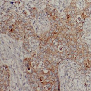 Creatine kinase MT 1A Antibody - BSA Free
