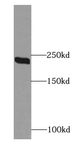 Citron Kinase Antibody - BSA Free