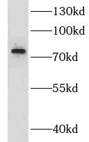 CIRH1A Antibody - BSA Free