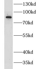 CILP2 Antibody - BSA Free