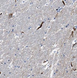 CHURC1 Antibody - BSA Free