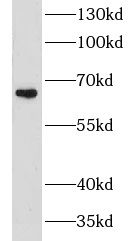 CHSY1 Antibody - BSA Free