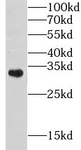 CHST8 Antibody - BSA Free