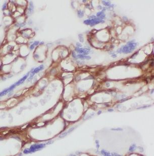 CHST14 Antibody - BSA Free