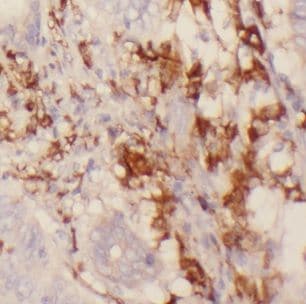 CHST12 Antibody - BSA Free