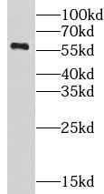 Carbohydrate Sulfotransferase 10/CHST10 Antibody - BSA Free