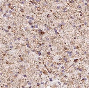 Carbohydrate Sulfotransferase 10/CHST10 Antibody - BSA Free