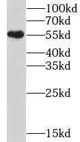 Nicotinic Acetylcholine Receptor beta 4 Antibody - BSA Free