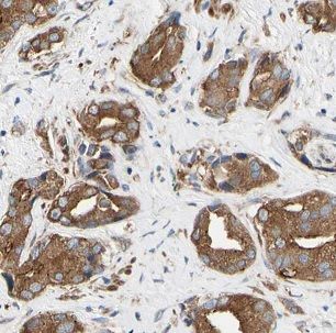 Nicotinic Acetylcholine R alpha 3/CHRNA3 Antibody - BSA Free